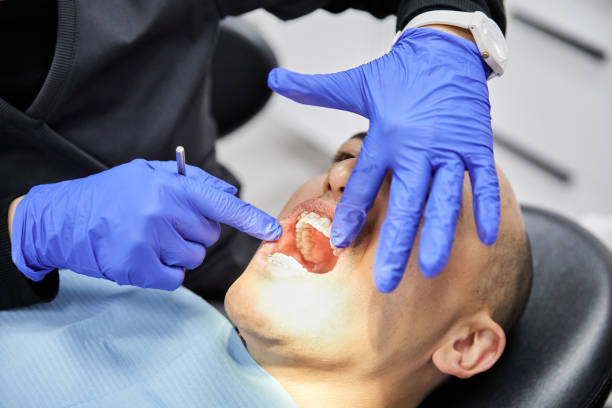 Best Emergency Tooth Extraction in River Bend, NC